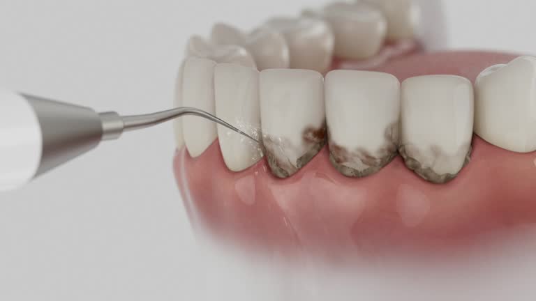 Reliable Tooth Extraction contractor in Ellaville, GA by Smile Center Dentistry